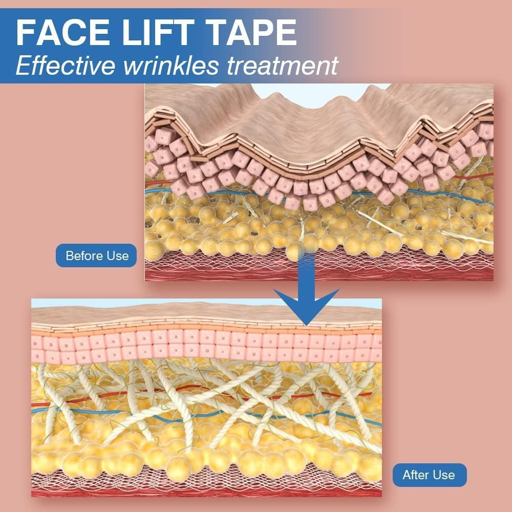 Professional Non-Invasive Facial Wrinkle Patch & Lifting Tape Roll (2.5cm x 1000cm) — Curated by Antarta
