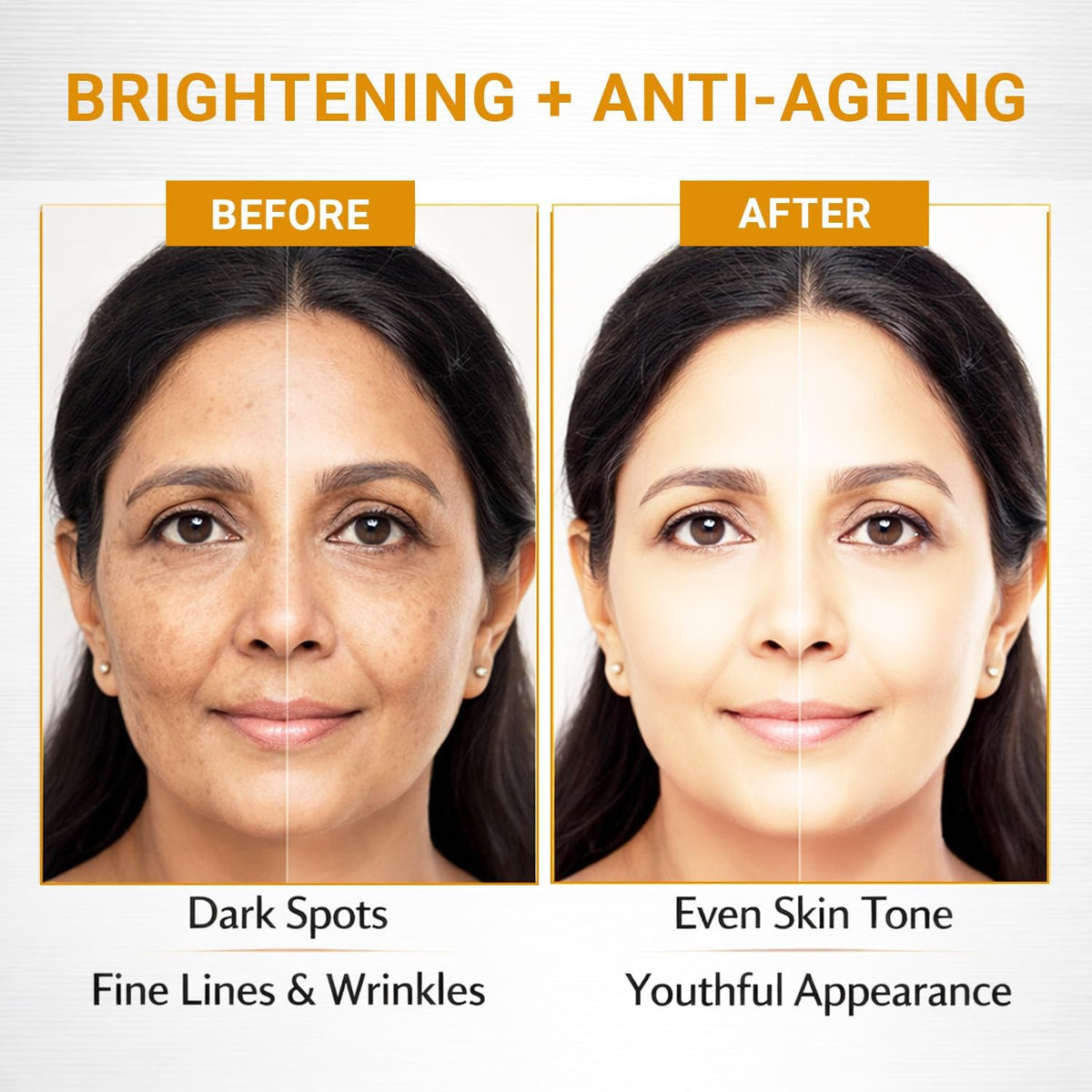 Antarta™ Gold Kesar Skin Renewal & Anti-Ageing Facial Kit (6-Piece Set)