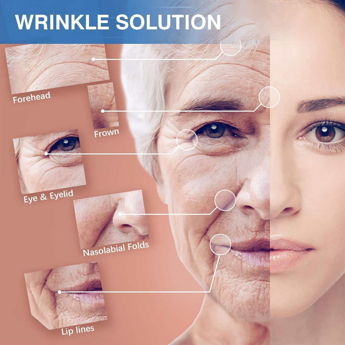 Professional Non-Invasive Facial Wrinkle Patch & Lifting Tape Roll (2.5cm x 1000cm) — Curated by Antarta
